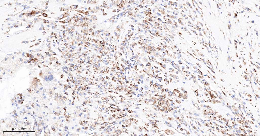 人丙酮酸脱氢酶激酶亚型2即用型免疫组化试剂盒-IHC0692H